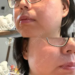 おおたかの森ビューティークリニック口コミ