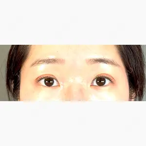 アリエル美容クリニック 大宮院口コミ