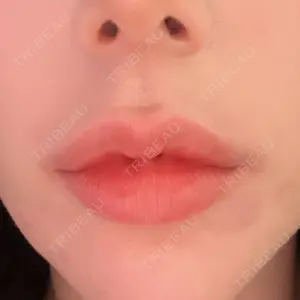 フィラークリニック 名古屋栄院口コミ