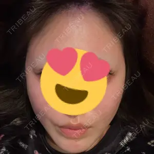 A CLINIC（エークリニック） 大阪院口コミ