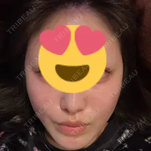 A CLINIC（エークリニック） 大阪院口コミ