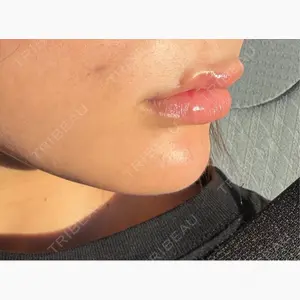 千葉美容外科アイビークリニック口コミ