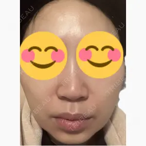 美容皮膚科エルムクリニック 麻布院口コミ