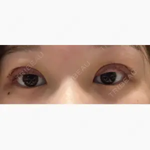 S.T styleクリニック口コミ