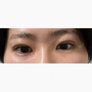 アリエル美容クリニック 大宮院口コミ