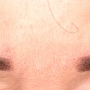 上野注入クリニック口コミ