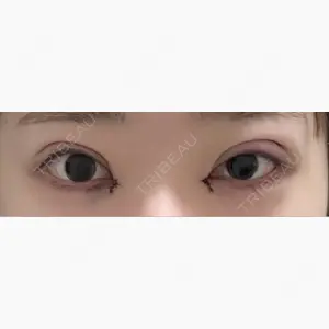 愛知春日井美容外科ネビュラクリニック口コミ