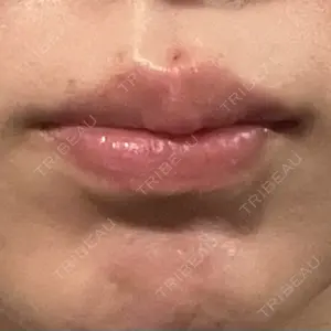 ルラ美容クリニック 福岡天神院口コミ