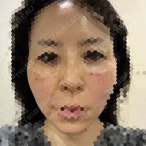 X CLINIC 大阪院口コミ