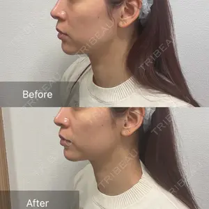 ビューティー和心クリニック 浅草院口コミ