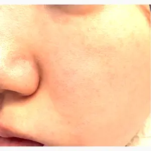 おおたかの森ビューティークリニック口コミ