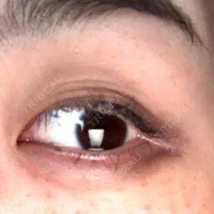 YBC横浜美容外科 立川院口コミ