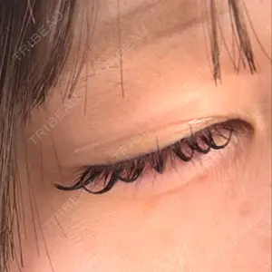 HAAB×DREAM BEAUTY CLINIC 東京本院口コミ