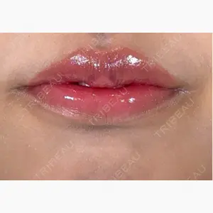 アリエル美容クリニック 横浜院口コミ