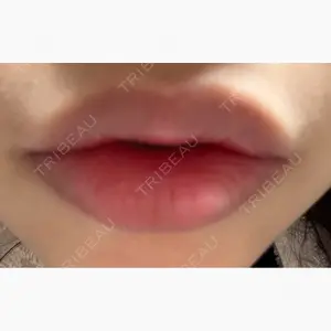 ルラ美容クリニック 大阪心斎橋院口コミ