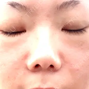 博多美容外科/美容皮膚科 ビラビューティークリニック口コミ