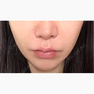 新宿ラクル美容外科クリニック 六本木院口コミ