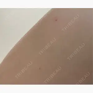 吉祥寺アイビークリニック口コミ