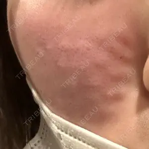 千葉美容外科アイビークリニック口コミ