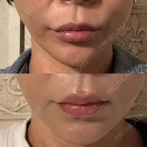 TCB東京中央美容外科 徳島院口コミ