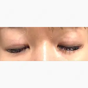 TCB東京中央美容外科 仙台駅前院口コミ