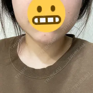 アールクリニック口コミ