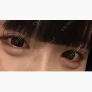 PRO CLINIC プロクリニック 銀座院口コミ