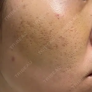 CLEAN BEAUTY CLINIC TokyoAzabu口コミ