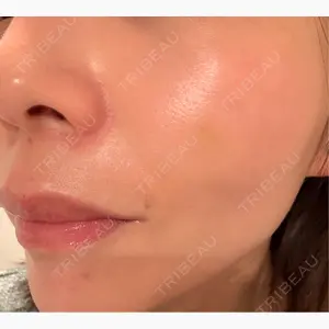 BON BON CLINIC 渋谷院口コミ