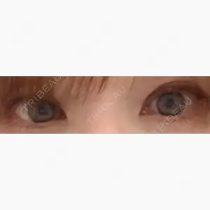 アリエル美容クリニック 水戸院口コミ