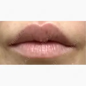 ルヴィクリニック イオンドーム前院口コミ