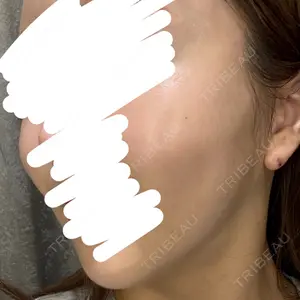 Days Beauty Clinic 新宿院口コミ