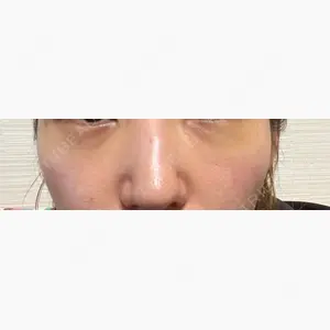 HAAB×DREAM BEAUTY CLINIC 大阪梅田院口コミ