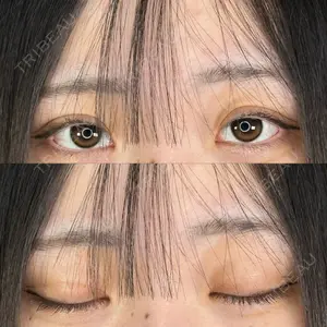 アリエル美容クリニック 郡山院口コミ