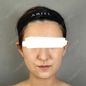 アリエル美容クリニック 大宮院口コミ