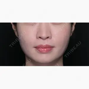 TCB東京中央美容外科 自由が丘院口コミ