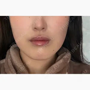 A CLINIC（エークリニック） 大阪院口コミ