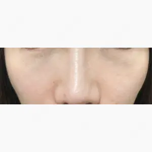 千葉美容外科アイビークリニック口コミ