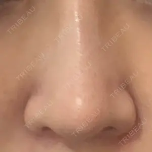 YBC横浜美容外科 池袋院口コミ