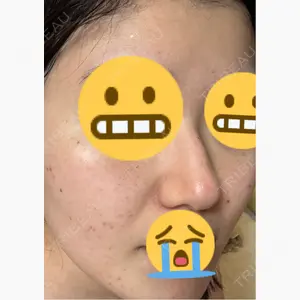 ライズワン美容皮膚科クリニック口コミ