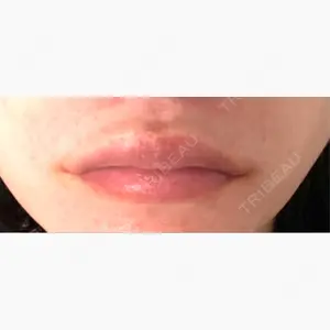 千葉美容外科アイビークリニック口コミ