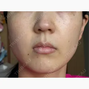 ルラ美容クリニック 静岡院口コミ