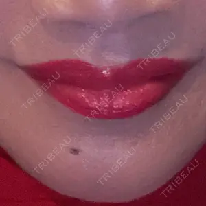 博多美容外科/美容皮膚科 ビラビューティークリニック口コミ