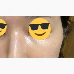 小倉美容外科ネビュラクリニック口コミ