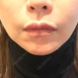 銀座TAクリニック口コミ