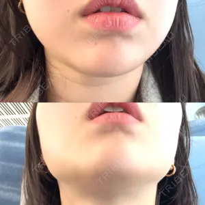 美容皮膚科ティファクリニック 新宿東口口コミ