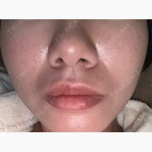 東京シルククリニック 東京神田院口コミ