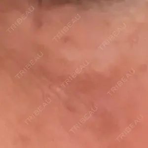 ルラ美容クリニック 横浜院口コミ