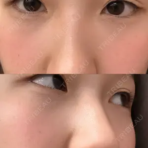 TCB東京中央美容外科 渋谷西口院口コミ