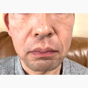 plume clinic口コミ